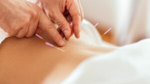 trattamento osteoarticlare-agopuntura-strambino-Ivrea