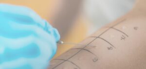 Allergologia e immunologia strambino - centro medico Artemisia - Ivrea